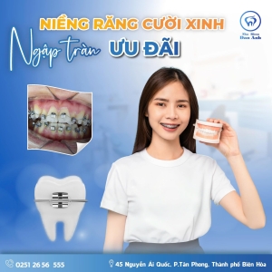 nieng-rang-cuoi-xinh-ngap-tran-uu-dai