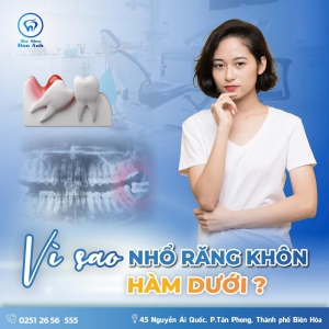 tai-sao-can-phai-nho-rang-khon-ham-duoi