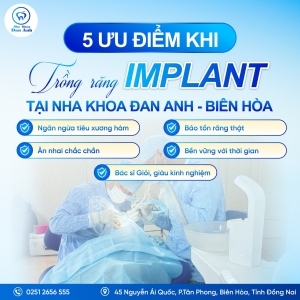 5-ly-do-nen-trong-rang-implant-tai-nha-khoa-dan-anh-bien-hoa-ngay