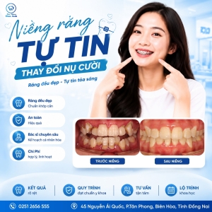 dia-chi-nieng-rang-uy-tin-tai-bien-hoa