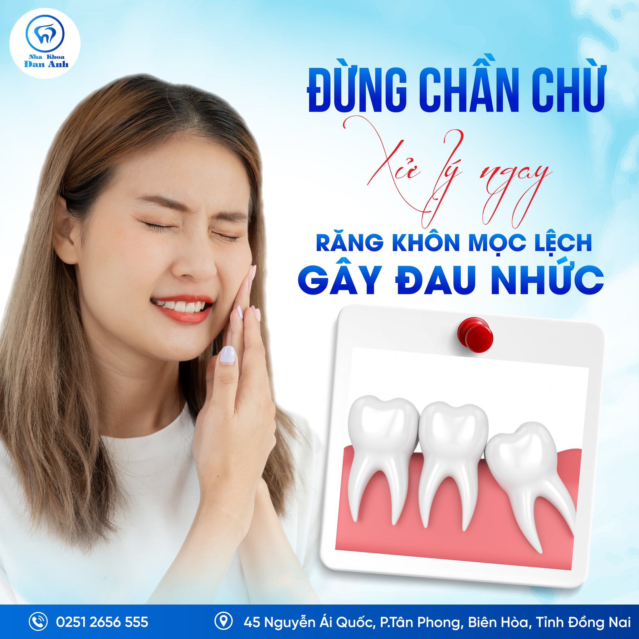 ĐỪNG CHẦN CHỪ, XỬ LÝ NGAY RĂNG KHÔN MỌC LỆCH GÂY ĐAU NHỨC!